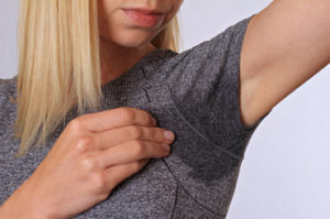 Underarm sweating injections Bristol