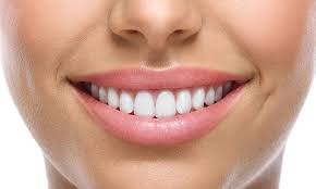 Nasolabial smile line treatments inBristol.
