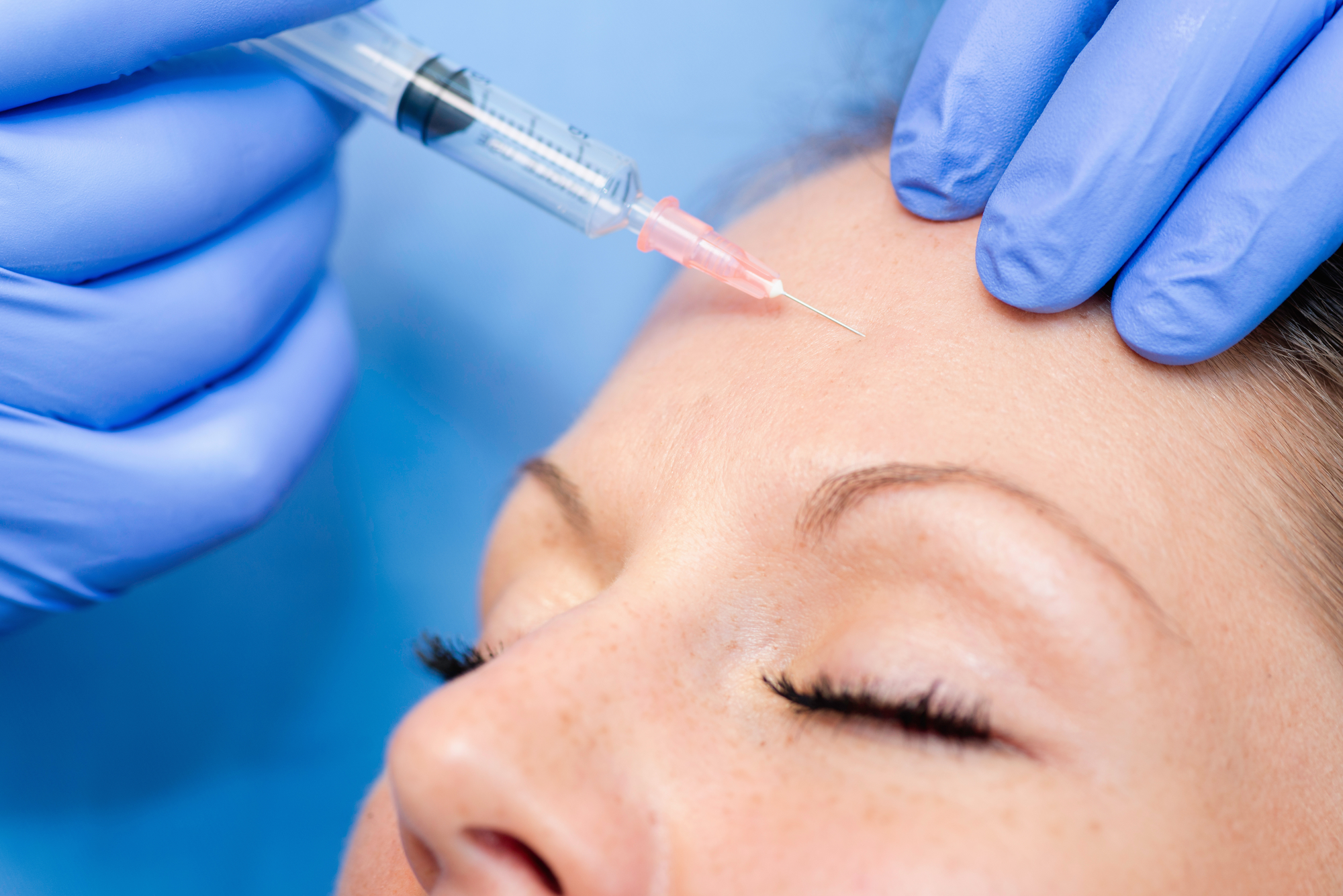 Botox injection treatments in Bristol by DoctorBrad.net