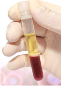 PRP test tube