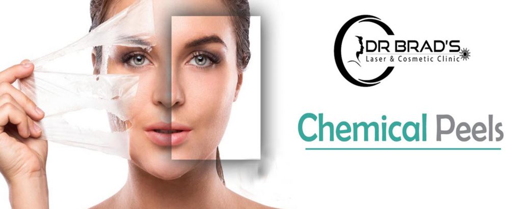 Chemical Peels Bristol