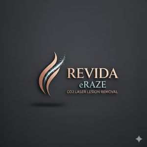 Revida eRaze