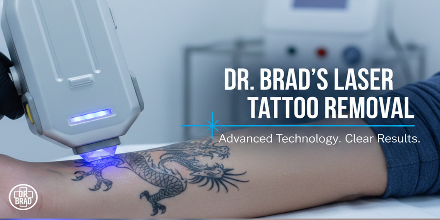 SmartXide-DOT banner laser tattoo removal clinic bristol