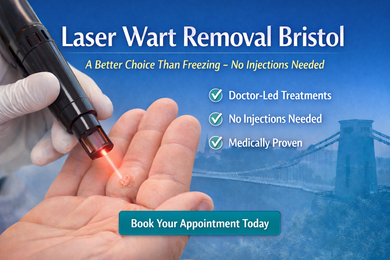 YAG laser wart removal bristol